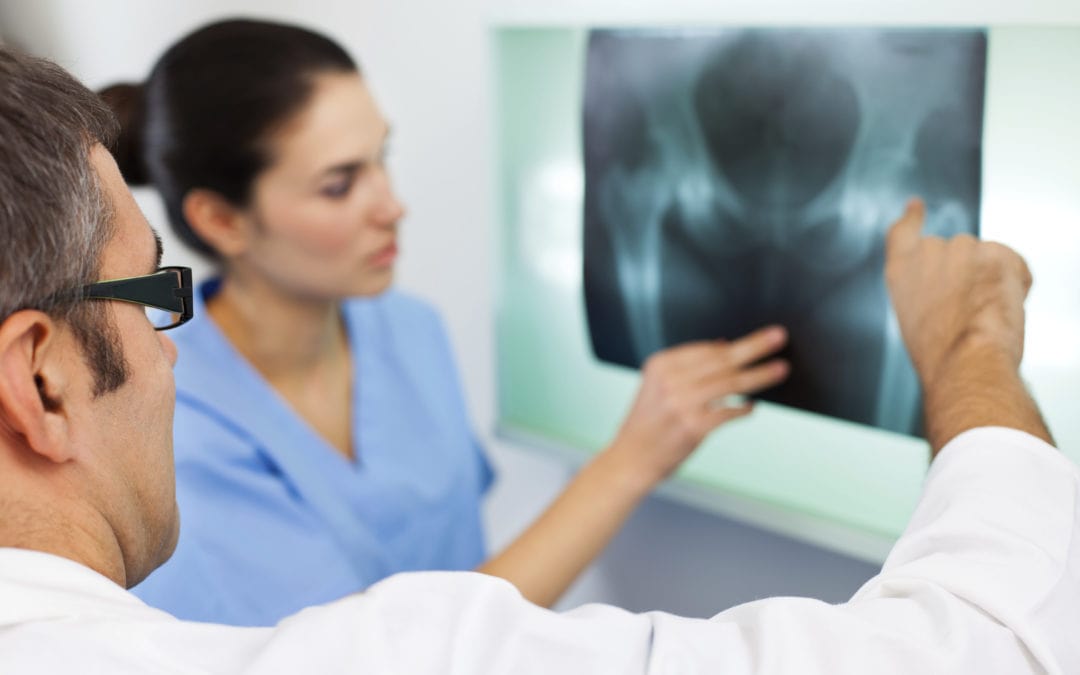 one-third of minimally invasive hip-replacement patients get tumors